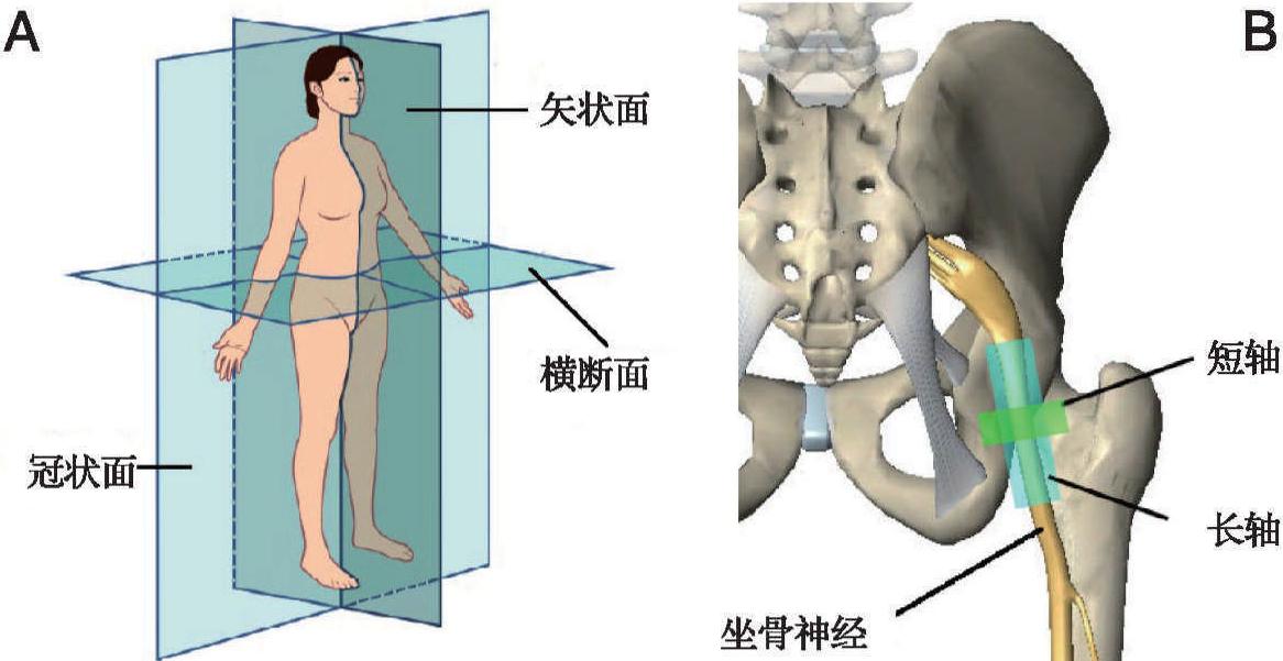 一、超聲引導(dǎo)神經(jīng)阻滯的相關(guān)術(shù)語(yǔ)